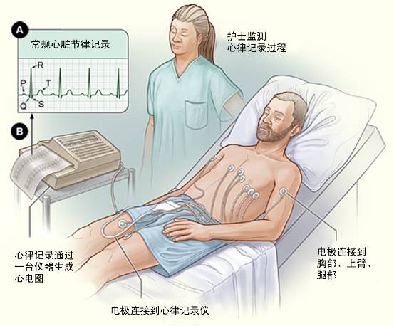 冠心病需要做哪些檢查？(圖1)